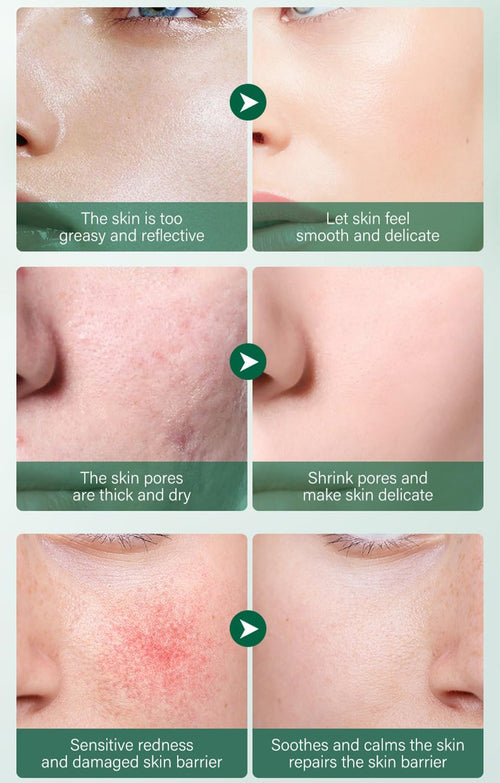 Centella Asiatica Skin Care set